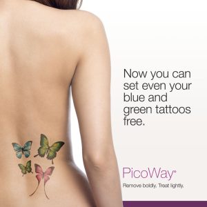 Picoway Can Remove Blue And Green Tattoo