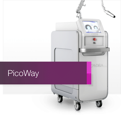 A picoway laser device used to remove tattoos.