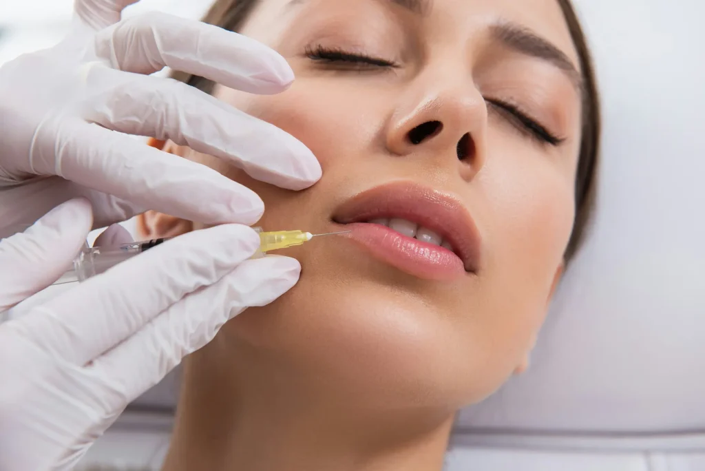 Medical professional wearing white gloves injects dermal filler into a woman's lips using a syringe with yellow fluid during a cosmetic procedure.