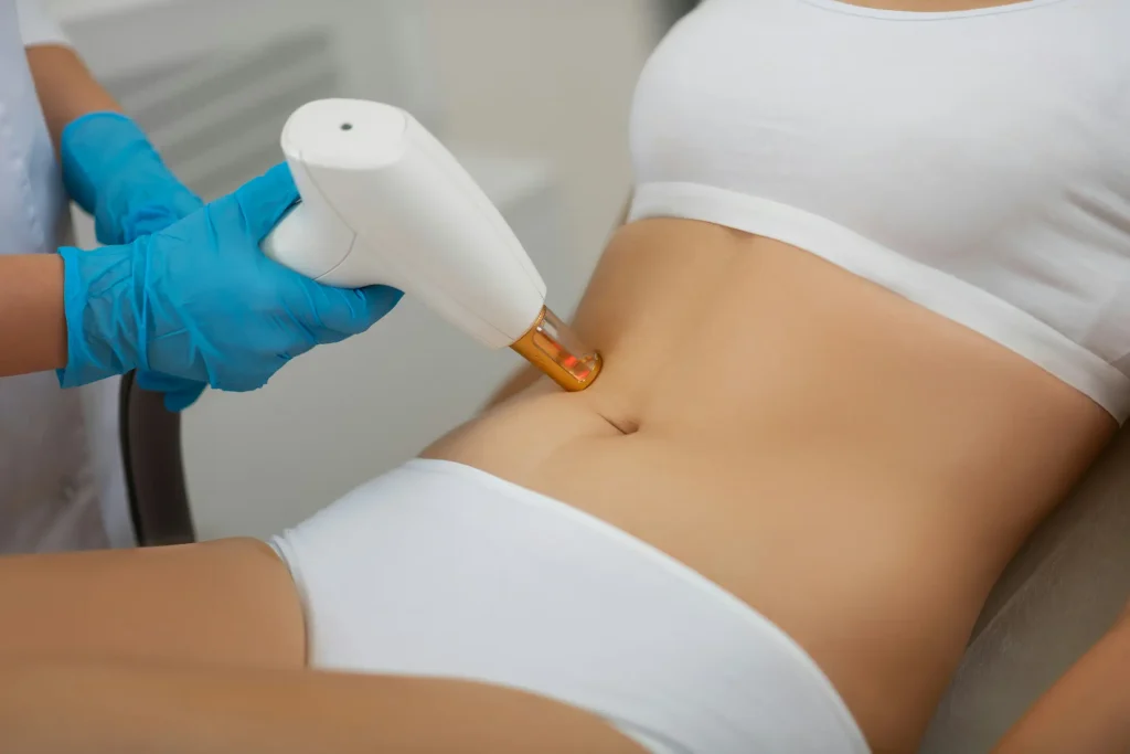 Medical professional in blue gloves uses white handheld laser device with orange light on woman's abdomen during cosmetic treatment.