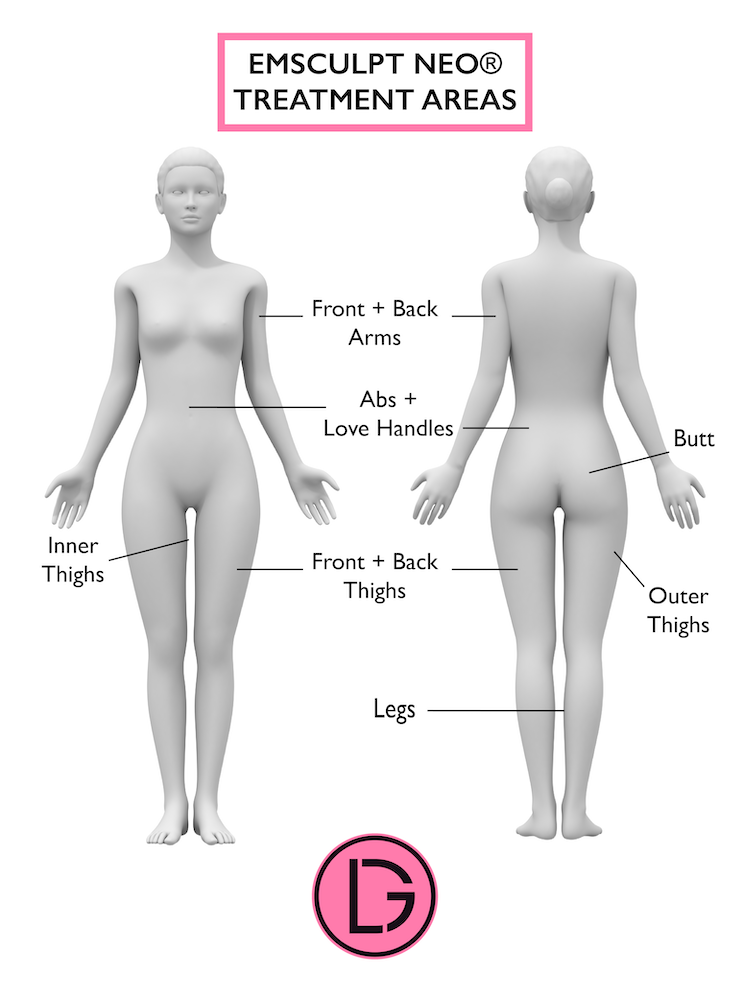 Diagram showing Emsculpt Treatment Areas in NYC Clinic