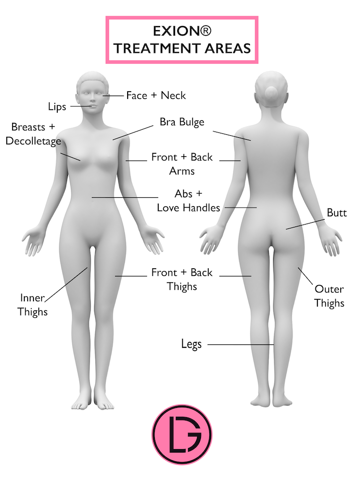 Diagram showing areas of face, neck, and body that can be treated with Exion