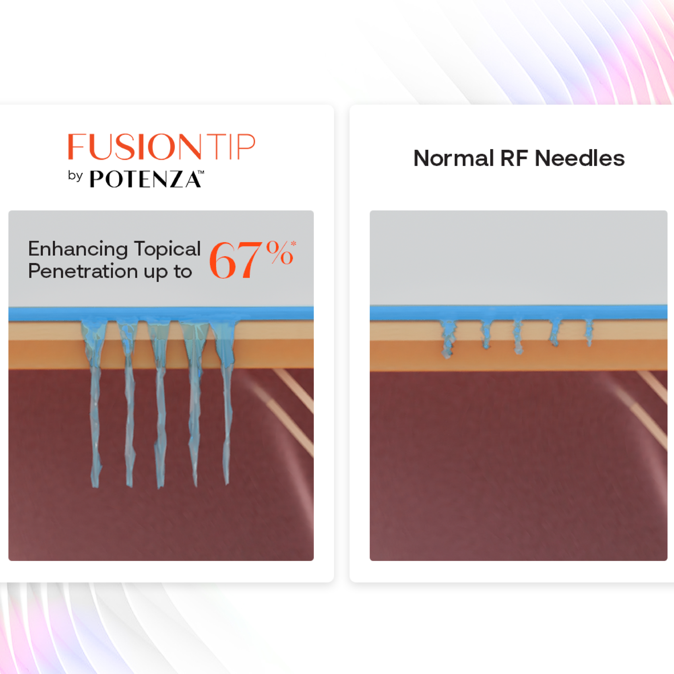Diagram showing superior penetration of topicals with Potenza Fusion Tip RF Microneedling compared to regular RF Microneedling