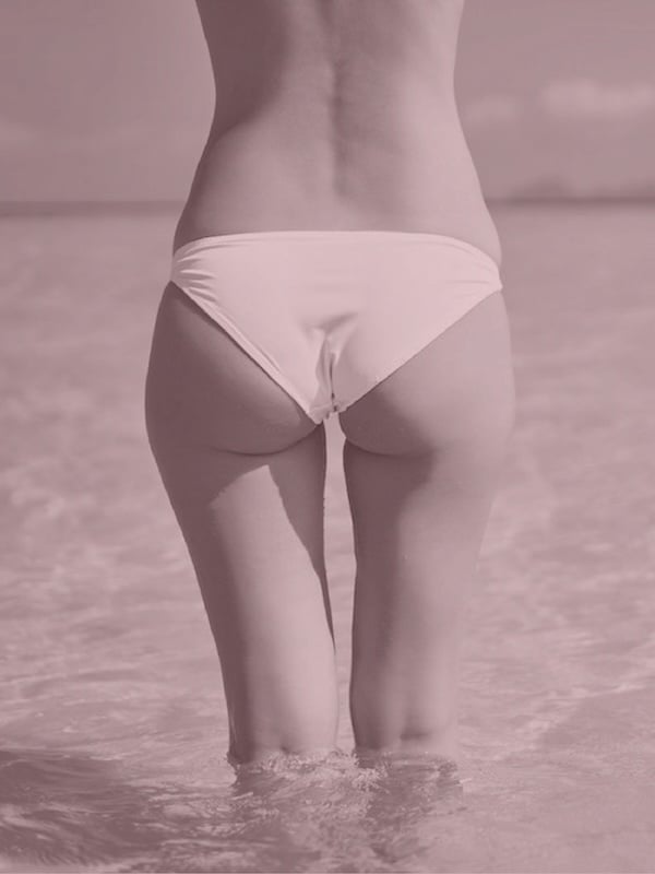 Woman's body after non-surgical body contouring and cellulite treatment in Midtown Manhattan
