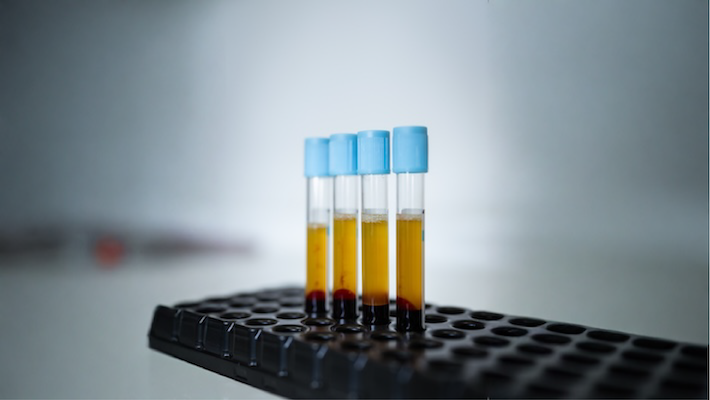 Prf Being Prepared For Scalp