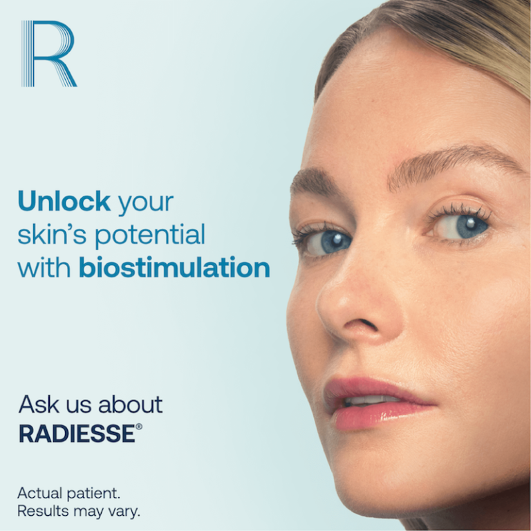 An image of a woman's face with overlying text saying: "Unlock your skin's potential with bistimulation. Ask us about Radiesse. Actual patient. Results may vary."